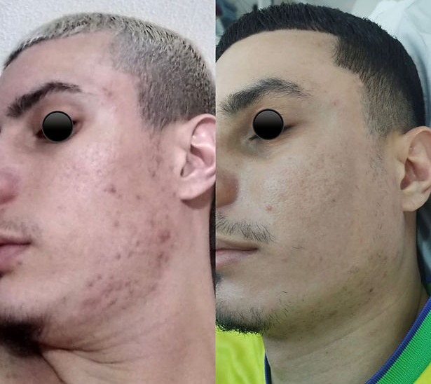 Procedimento 12