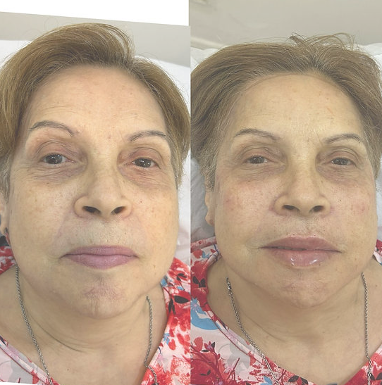 Procedimento 24